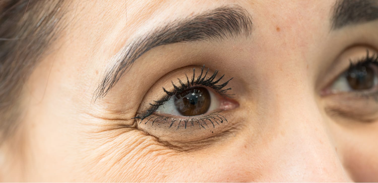 A woman with crow's feet around her eyes