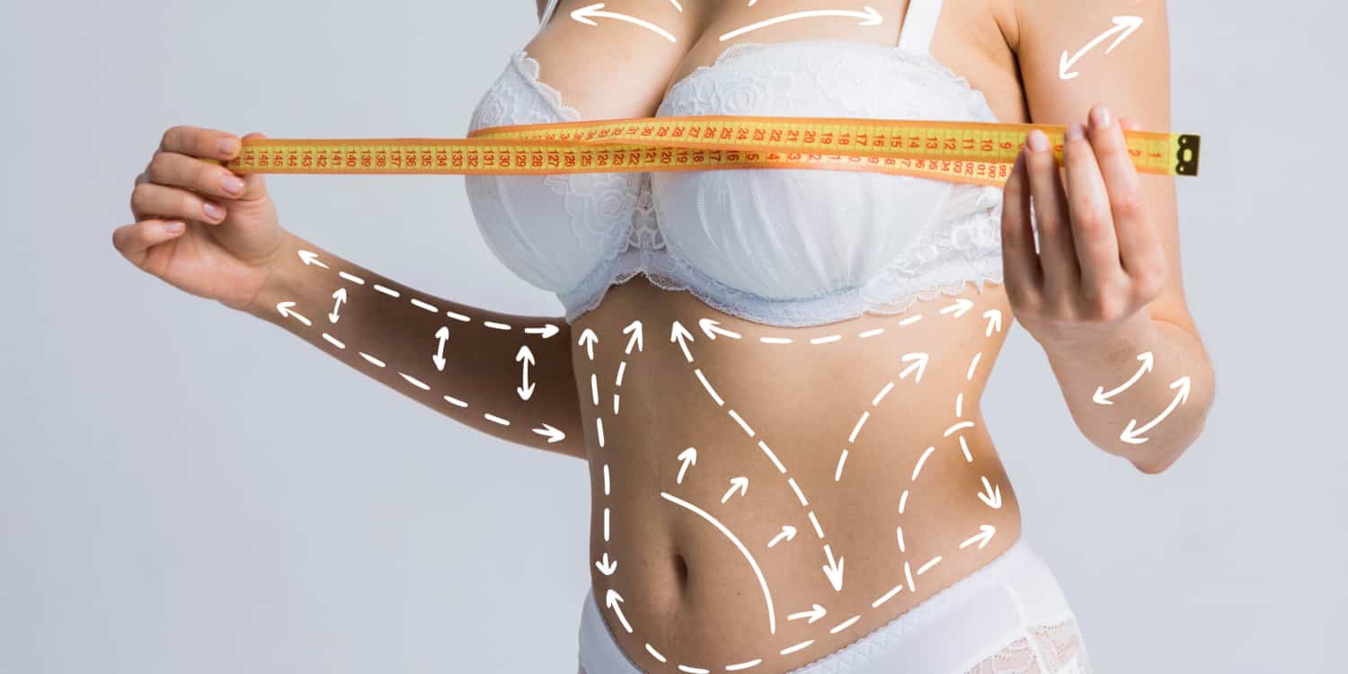 A woman in a white bra with white lines marking plastic surgery combinations